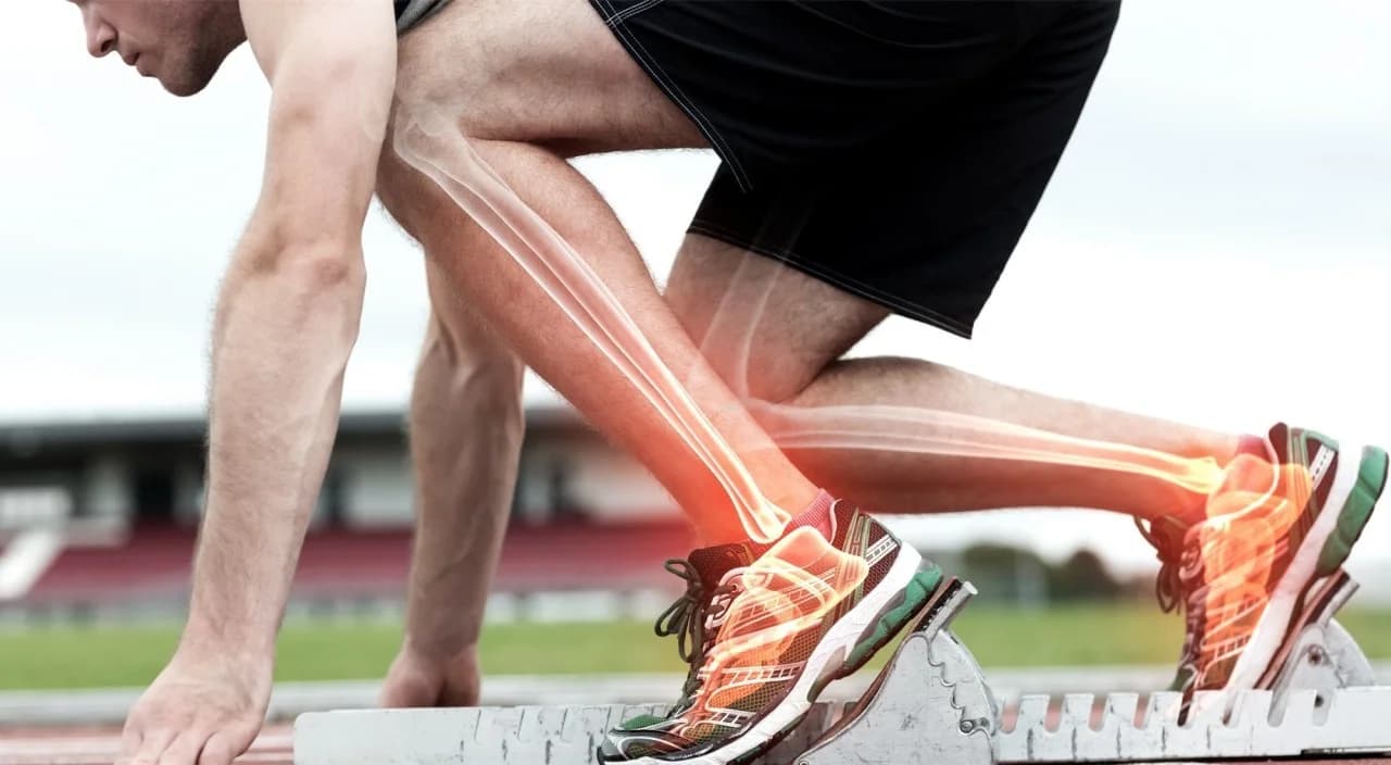 Pie Chapín — Técnica de Ponseti